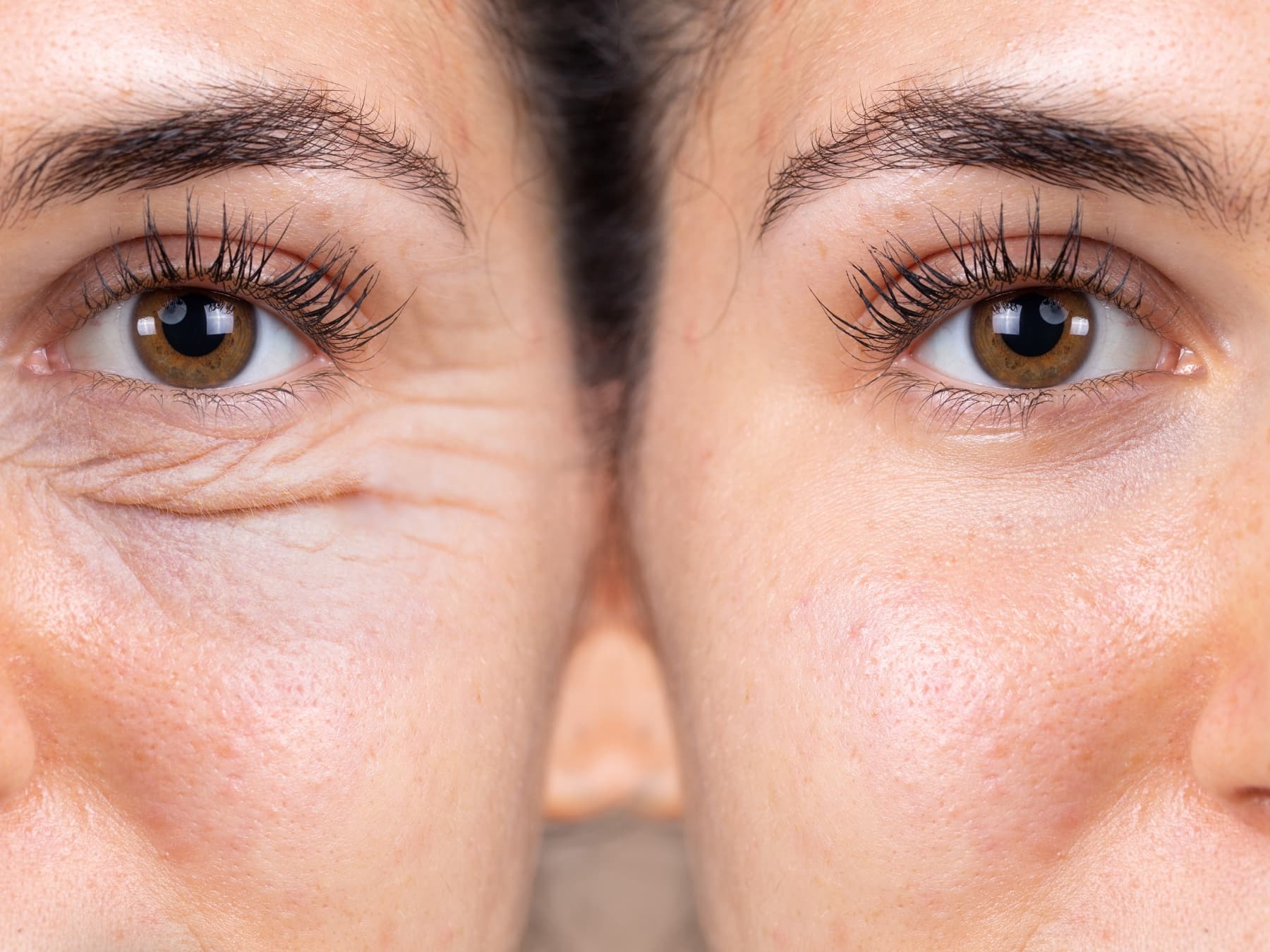 Erholung nach der Blepharoplastik